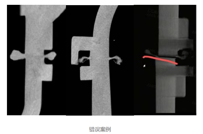 The Shift from Aluminum to Plastic in Dual-Chamber Air Springs: A Technological Advancement